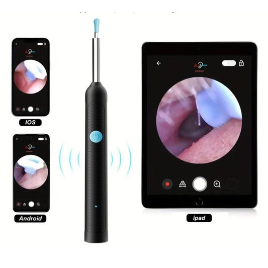 Amfyn Earwax Cleaner With Camera (Multicolor )