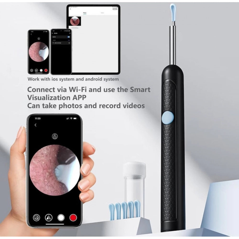 Amfyn Earwax Cleaner With Camera (Multicolor )